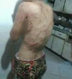 Jovem é atacada por dois cães rottweiler no município de Macambira