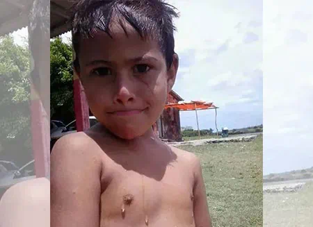 Criança de cinco anos de idade morre vítima de bala perdida em São Domingos